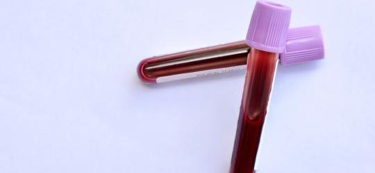 Próbki krwi w fiolkach przeznaczone do badania poziomu mioglobiny.