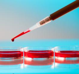 Monocyty: jaki jest prawidłowy poziom?