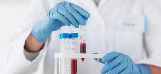 Morfologia krwi - jak interpretować wyniki?