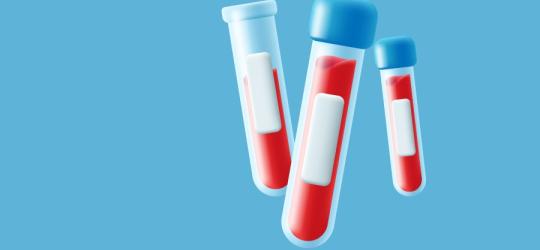 Rysunkowe fioli z krwią przeznaczoną do morfologii z rozmazem.