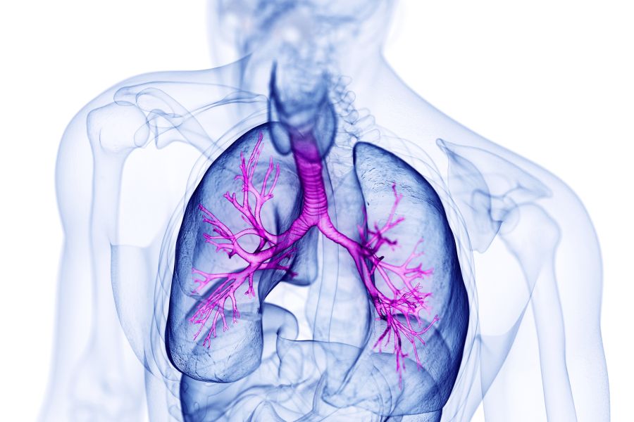 Mukowiscydoza - przyczyny, objawy, leczenie