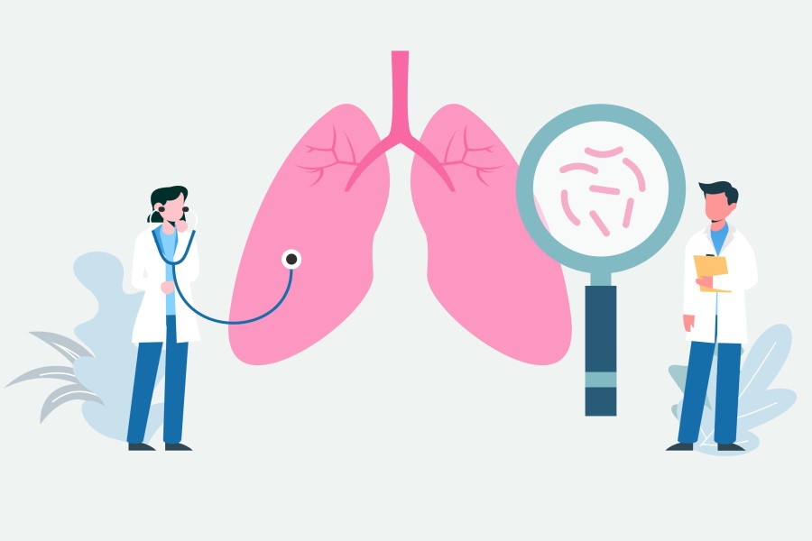 Rysunkowi lekarze diagnozujący w płucach zakażenie Mycoplasma pneumoniae.