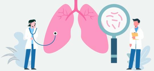 Rysunkowi lekarze diagnozujący w płucach zakażenie Mycoplasma pneumoniae.