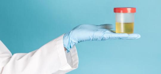 Diagnosta trzyma w dłoni kubeczek z próbką moczu pacjenta.