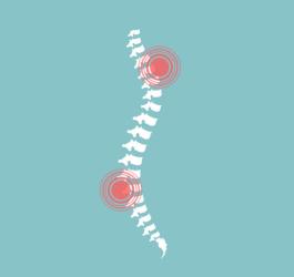 Najczęstsze przyczyny bólu kręgosłupa