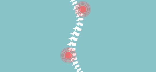 Najczęstsze przyczyny bólu kręgosłupa
