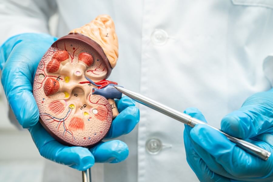 Lekarz pokazuje model nerki.