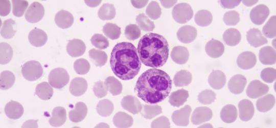 Neutrofile poniżej normy. Jakie są przyczyny?