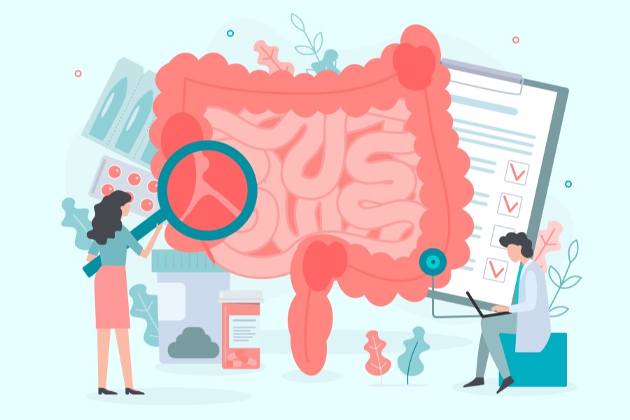 Rysunkowi lekarze szukają przyczyny niedrożności jelit na rysunkowym modelu tych narządów.