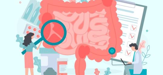 Rysunkowi lekarze szukają przyczyny niedrożności jelit na rysunkowym modelu tych narządów.