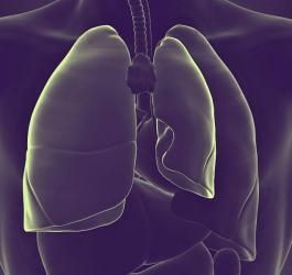 Płuca człowieka z widoczną odmą opłucnową.