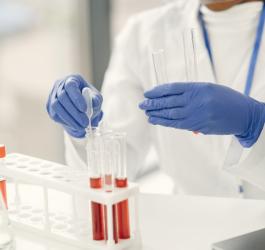 Diagnosta podczas pracy nad próbkami krwi pacjenta. Będzie sprawdzał poziom osteokalcyny.