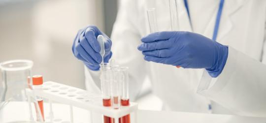 Diagnosta podczas pracy nad próbkami krwi pacjenta. Będzie sprawdzał poziom osteokalcyny.