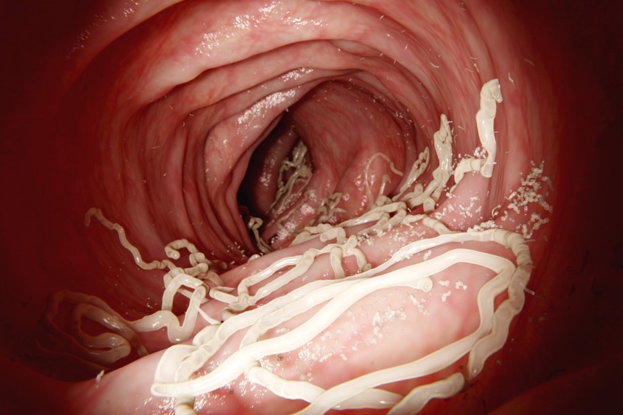 Pasożyt obecny w ludzkim przewodzie pokarmowym.