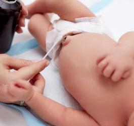 Mama pielęgnuje kikut pępowinowy u noworodka.