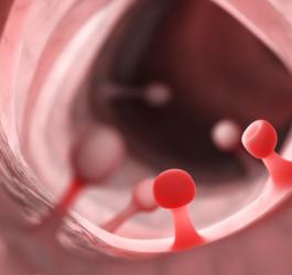 Polipy jelita grubego w powiększeniu.