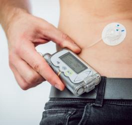 Mężczyzna korzystający z pompy insulinowej.