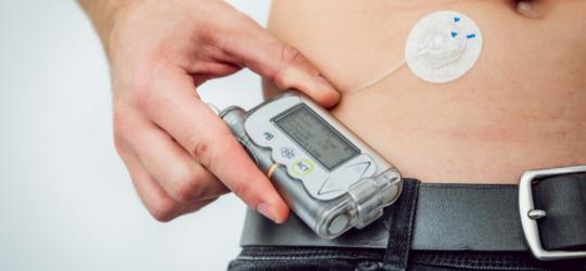 Mężczyzna korzystający z pompy insulinowej.