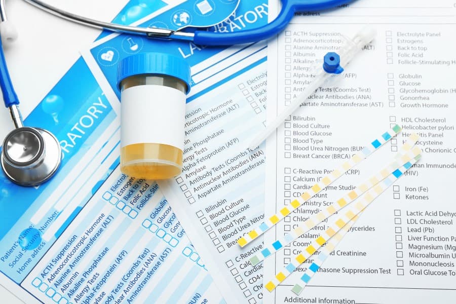 Próbka moczu w kubeczku zebrana do posiewu moczu z antybiogramem.