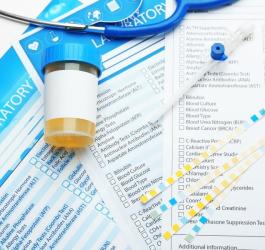 Próbka moczu w kubeczku zebrana do posiewu moczu z antybiogramem.