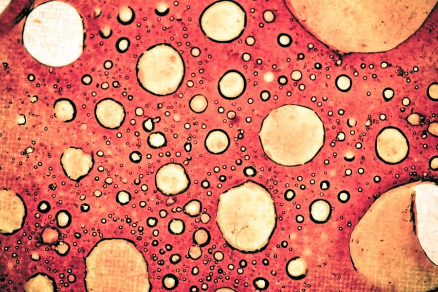 Komórki rakowe w powiększeniu.