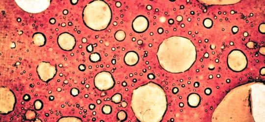 Komórki rakowe w powiększeniu.