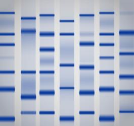 Wyniki proteinogramu na płytce żelowej.