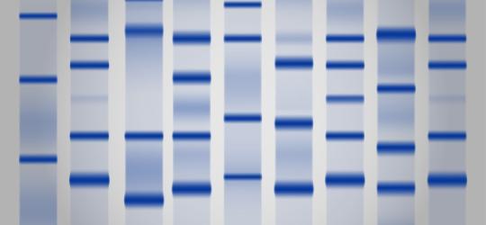 Wyniki proteinogramu na płytce żelowej.