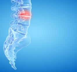 Przepuklina kręgosłupa - objawy