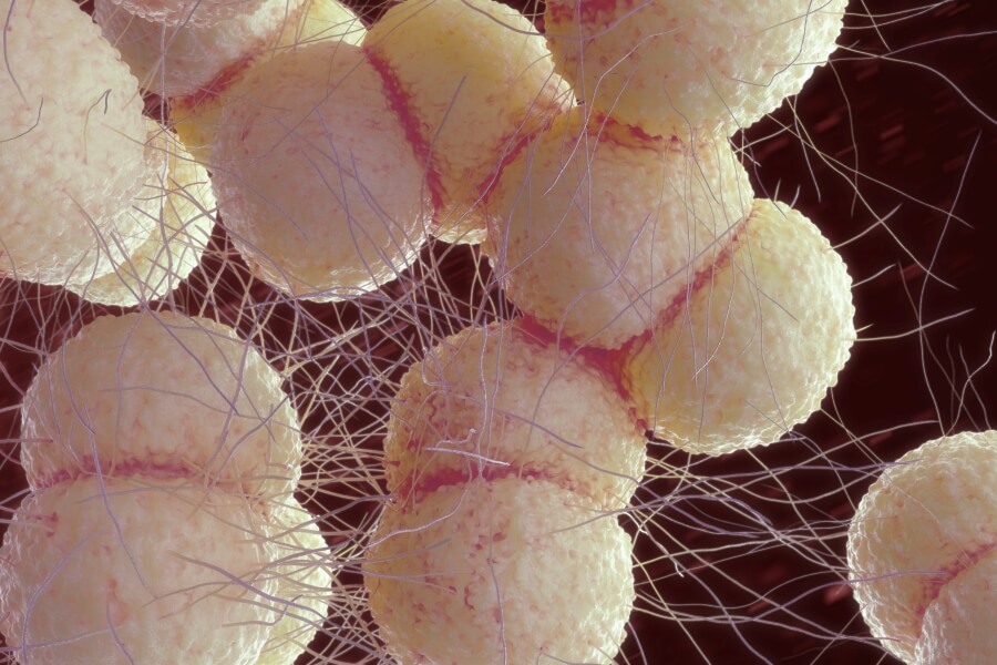 Rzeżączka - objawy, metody zapobiegania i leczenia