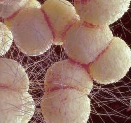 Rzeżączka - objawy, metody zapobiegania i leczenia