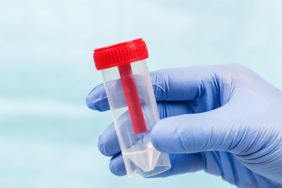 Pojemnik do pobrania próbki kału, którą można zbadać m.in. na obecność śluzu.