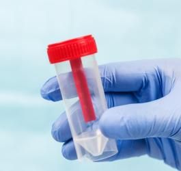 Pojemnik do pobrania próbki kału, którą można zbadać m.in. na obecność śluzu.