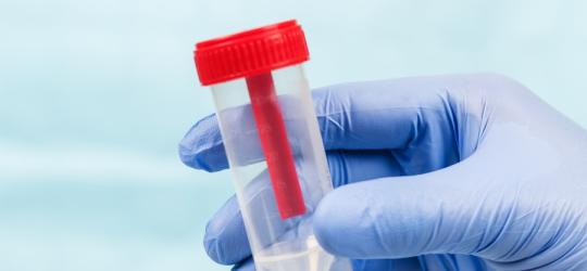 Pojemnik do pobrania próbki kału, którą można zbadać m.in. na obecność śluzu.