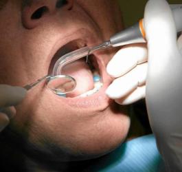 Mężczyzna podczas przeglądu stomatologicznego.