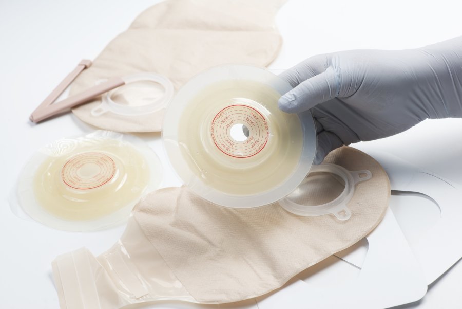 Stomia – czym jest i kiedy jej zastosowanie jest konieczne?