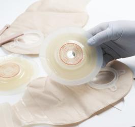 Stomia – czym jest i kiedy jej zastosowanie jest konieczne?