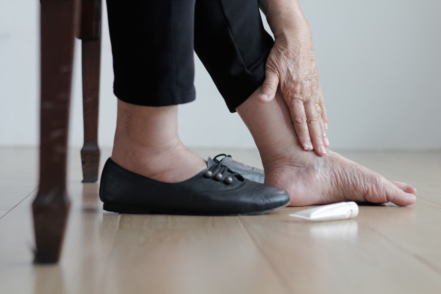 Kobieta smaruje stopę kremem, aby uniknąć zespołu stopy cukrzycowej.