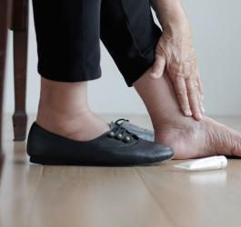 Kobieta smaruje stopę kremem, aby uniknąć zespołu stopy cukrzycowej.