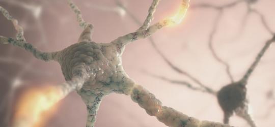 Stwardnienie rozsiane: rodzaje, rozpoznanie, sposoby leczenia