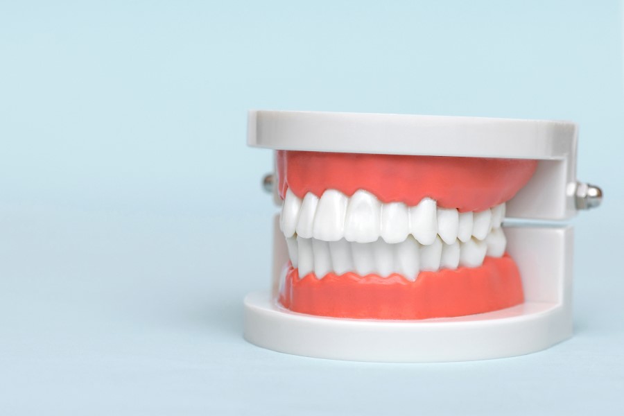 Model ludzkiej szczęki z zaciśniętymi zębami.