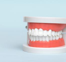 Model ludzkiej szczęki z zaciśniętymi zębami.