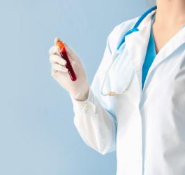 Lekarka trzyma w dłoni fiolkę z krwią pacjenta, przeznaczoną do testu OGGT czyli krzywej cukrowej.