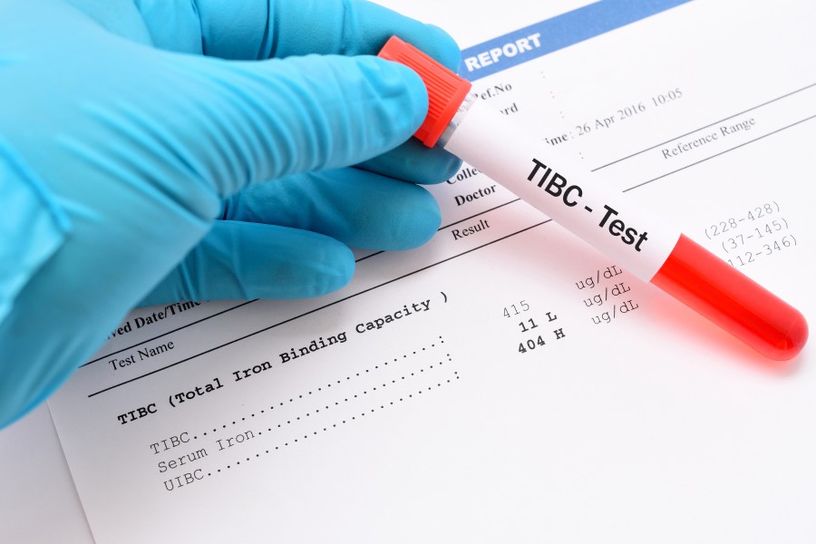 Fiolka z krwią przeznaczoną do badania TIBC.