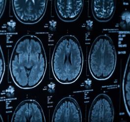 Zdjęcie tomografii komputerowej głowy.