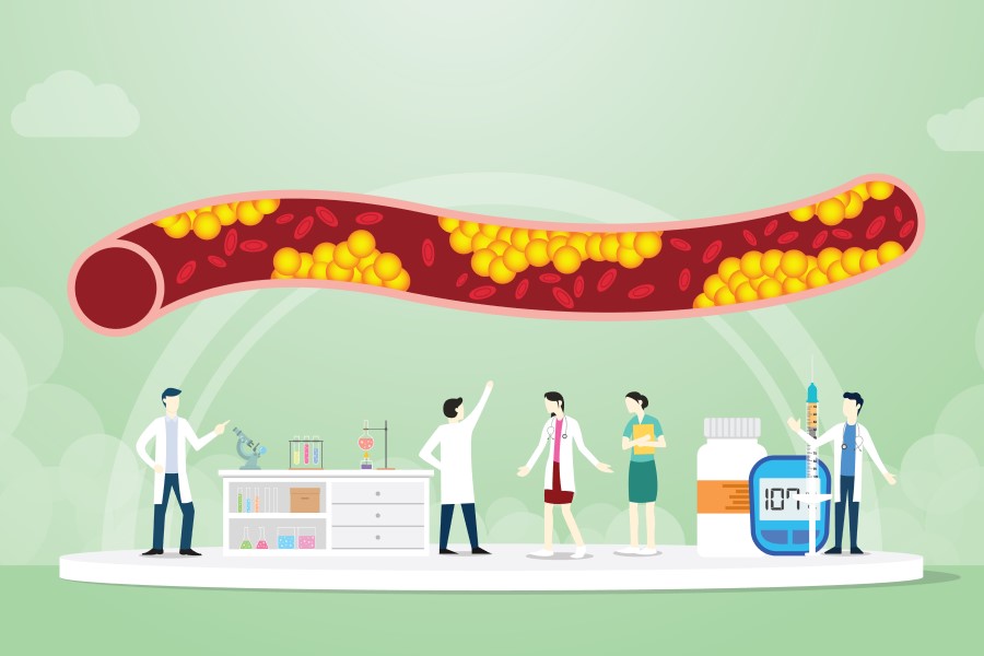 Grafika 2D. Rysunkowi lekarza leczą podwyższone stężenie trójglicerydów i miażdżycę.