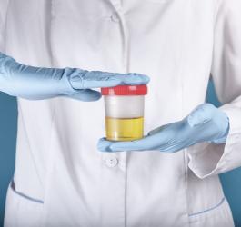 Lekarz trzyma w rękach próbkę moczu pacjenta, zamkniętą w pojemniku.