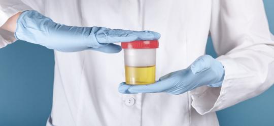 Lekarz trzyma w rękach próbkę moczu pacjenta, zamkniętą w pojemniku.