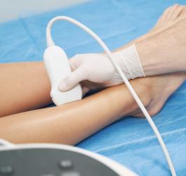 Pacjenta podczas badania USG dopplerowskiego kończyn dolnych.