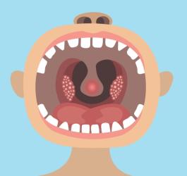 Usuwanie migdałków u dzieci